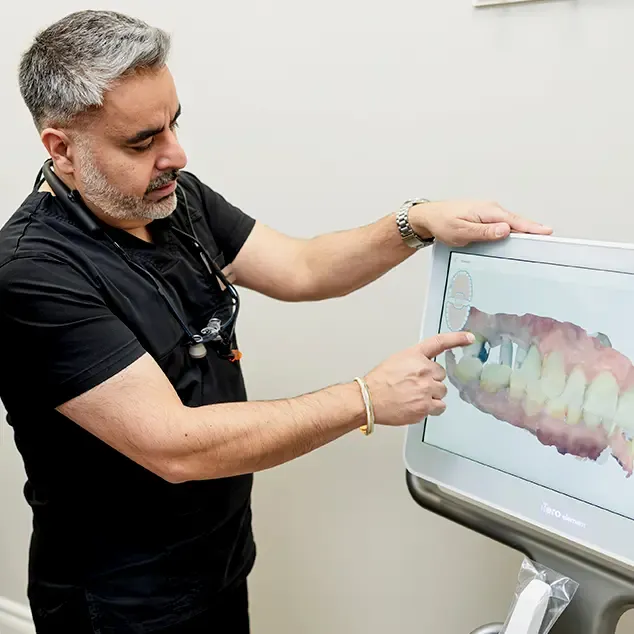 Model of a dental implant