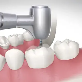 Screenshot from Optio Dentistry video