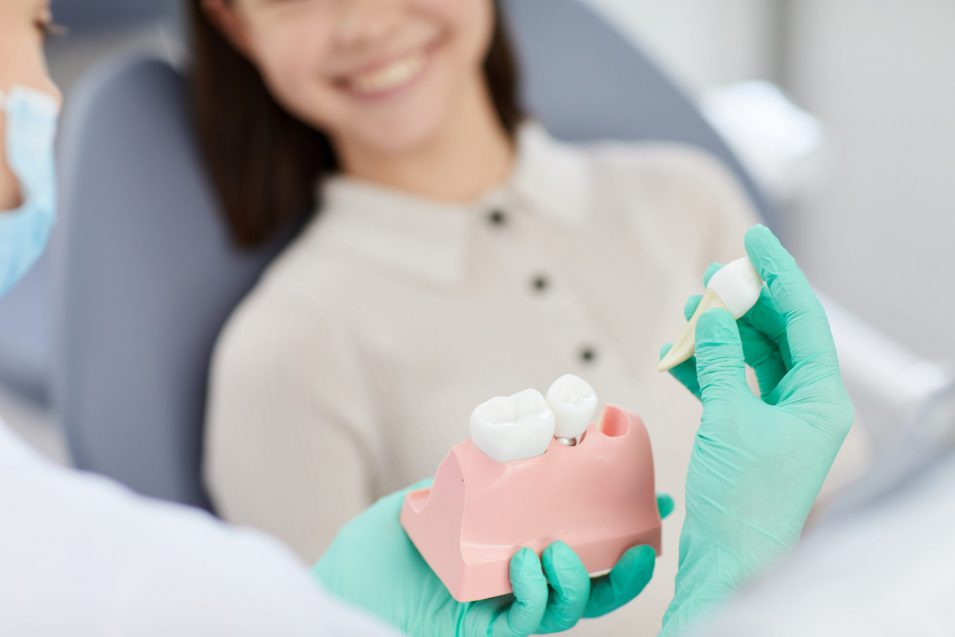 Root Canals and Teeth Extractions performed in Oakville